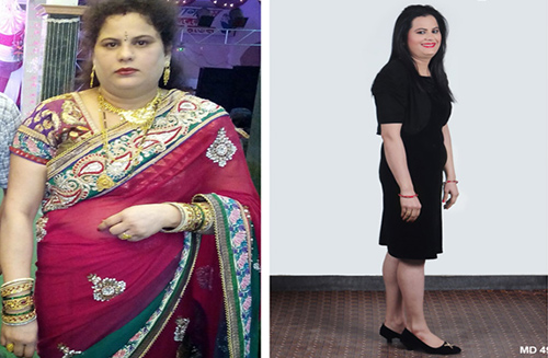 Body Slimming